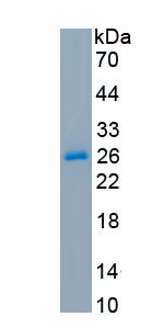 Active Carbonic Anhydrase IV (CA4)