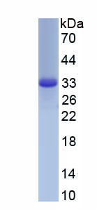 Active Carbonic Anhydrase XIII (CA13)