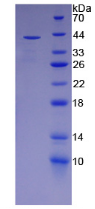 Active Paraoxonase 2 (PON2)