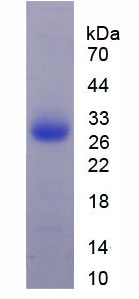 Active Complement Component 1, Q Subcomponent A (C1qA)