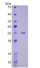 Active Cytochrome P450 3A4 (CYP3A4)