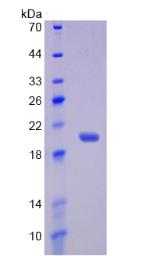 Active Interleukin 17 Receptor B (IL17RB)