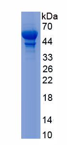 Active Kallistatin (KAL)