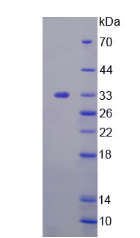 Active Tyrosine Aminotransferase (TAT)