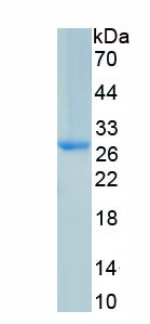 Active Ephrin A3 (EFNA3)