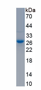 Active Ephrin A5 (EFNA5)