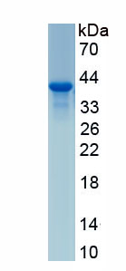 Active Lactate Dehydrogenase C (LDHC)