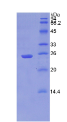 Active Puromycin Sensitive Aminopeptidase (PSA)