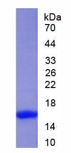 Active Puromycin Sensitive Aminopeptidase (PSA)