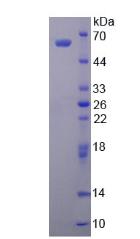 Active Aldehyde Dehydrogenase 1 Family, Member A1 (ALDH1A1)
