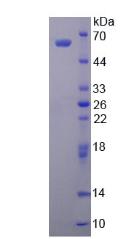 Active Aldehyde Dehydrogenase 1 Family, Member A1 (ALDH1A1)