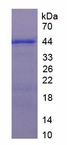 Active Complement Component 1, Q Subcomponent C (C1qC)