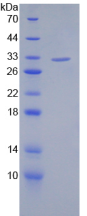 Active Sirtuin 3 (SIRT3)