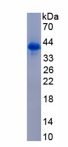 Active Centaurin Alpha 2 (CENTa2)