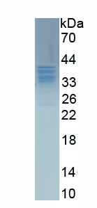 Active Phosphodiesterase 1A, Calmodulin Dependent (PDE1A)