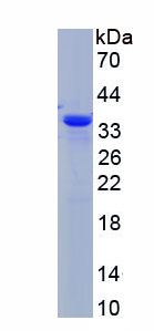 Active Peptidyl Arginine Deiminase Type IV (PADI4)
