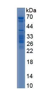 Active Taste Receptor Type 1 Member 3 (TAS1R3)