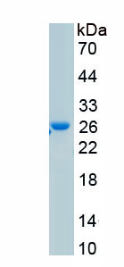 Active S-Phase Kinase Associated Protein 1 (SKP1)