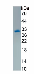 Active Glycine Dehydrogenase (GLDC)