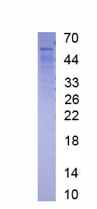 Active Hepatocyte Nuclear Factor 1 Alpha (HNF1a)