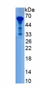 Active Hepatocyte Nuclear Factor 1 Alpha (HNF1a)
