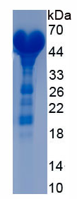 Active Hepatocyte Nuclear Factor 1 Alpha (HNF1a)