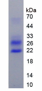 Active Cold Inducible RNA Binding Protein (CIRBP)