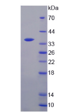 Active Thymidylate Synthetase (TYMS)