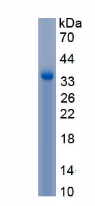 Active Homeobox Protein B4 (HOXB4)