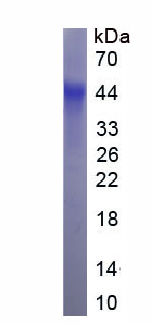 Active Hepatitis A Virus Cellular Receptor 2 (HAVCR2)