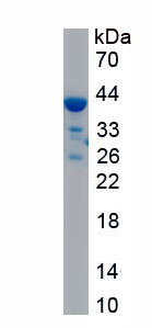 Active Dihydroorotate Dehydrogenase (DHODH)