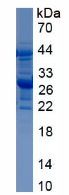Active Diacylglycerol-O-Acyltransferase Homolog 1 (DGAT1)
