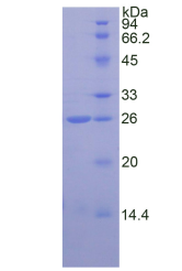 Active Catechol-O-Methyltransferase (COMT)