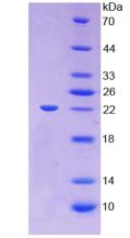 Active Lecithin Cholesterol Acyltransferase (LCAT)