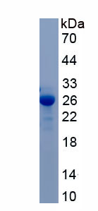 Active RAB7A, Member RAS Oncogene Family (RAB7A)