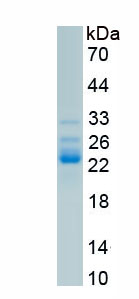 Active GRB2 Associated Binding Protein 1 (GAB1)