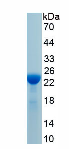 Active C-Type Lectin Domain Family 3, Member B (CLEC3B)