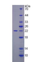 Active Growth Arrest And DNA Damage Inducible Protein Alpha (GADD45a)