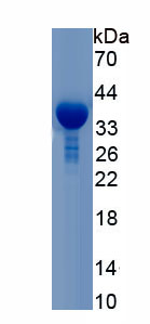 Active Steroid 5 Alpha Reductase 2 (SRD5a2)