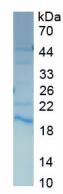 Active Fibronectin Type III Domain Containing Protein 5 (FNDC5)