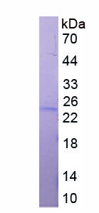 Active Mitochondrial Ribosomal Protein S4 (MRPS4)