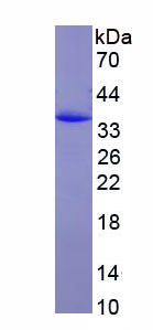 Active Short Palate, Lung And Nasal Epithelium Carcinoma Associated Protein 2 (SPLUNC2)