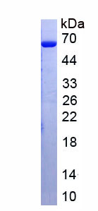 Active Taq Polymerase (Taq)