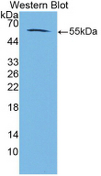 Anti-Calnexin (CNX) Polyclonal Antibody