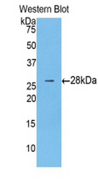 Anti-Beta Catenin (β-catenin) Polyclonal Antibody