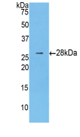 Anti-Beta Catenin (β-catenin) Polyclonal Antibody