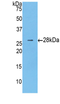 Anti-Beta Catenin (β-catenin) Monoclonal Antibody