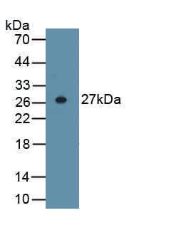 Anti-Actin Alpha 2, Smooth Muscle (ACTa2) Polyclonal Antibody