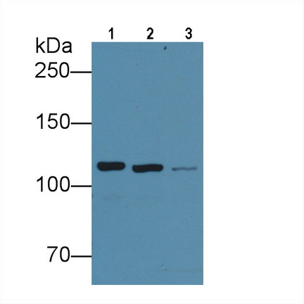 Anti-Vinculin (VCL) Monoclonal Antibody