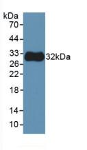 Anti-Tubulin Beta (TUBb) Monoclonal Antibody